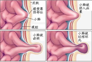 肝脏在身体那个部位 求图