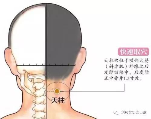 头颈前移矫正之颈部肌肉放松与牵伸